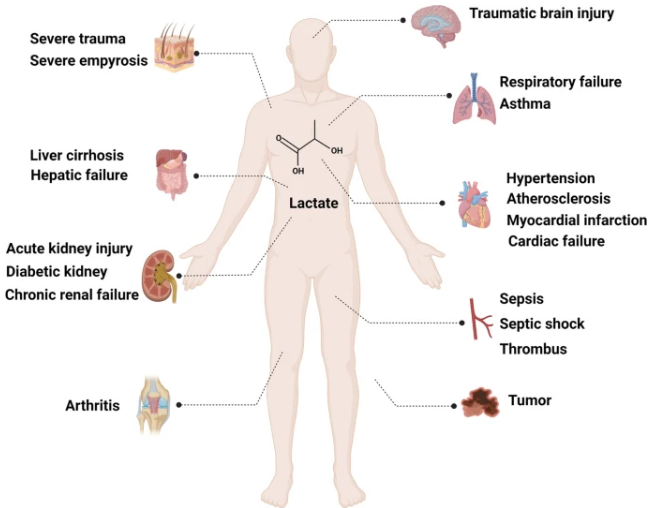 Figure_3._Lactic_acid_is_involved_in_various_of_diseases_[2].png